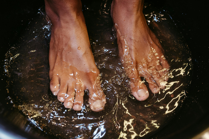 Need to Heal Dry, Cracked Heels?